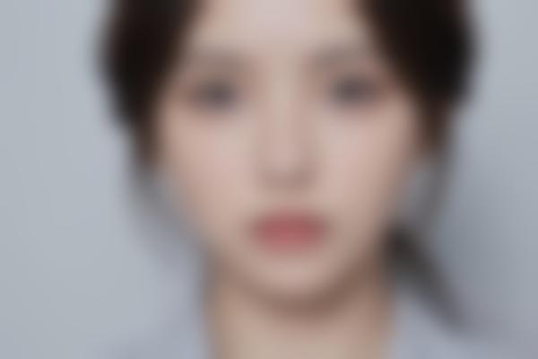 神经整形是什么？这项新技术如何改善面部年轻化