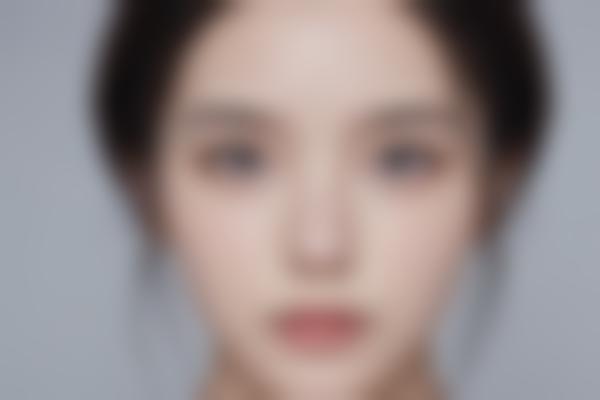 成都蓉蓉晓艾医疗美容诊所怎么样？实力与特色项目解析