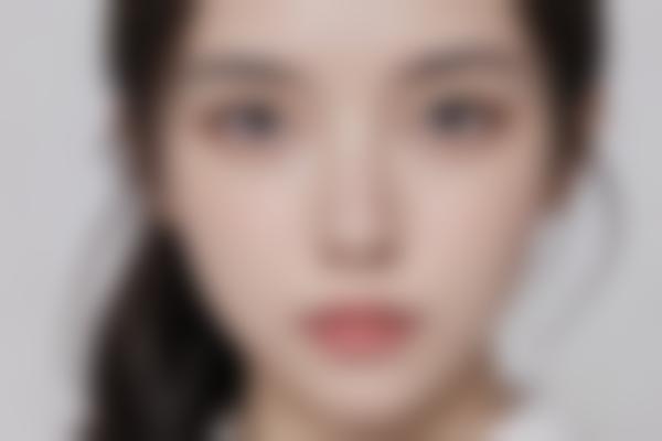 深圳面部五官整形2025价格表：双眼皮/隆鼻/下巴等手术收费标准明细