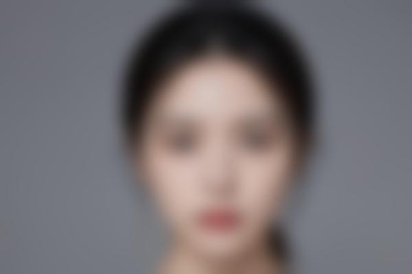 眉毛移植的术后护理