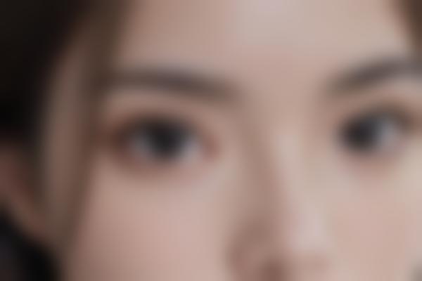 {眼综合整形：一站式解决眼部问题的科学方案