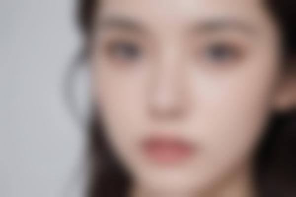 徐州美玲医疗美容价格表2025更新：玻尿酸填充、脂肪移植等项目收费一览