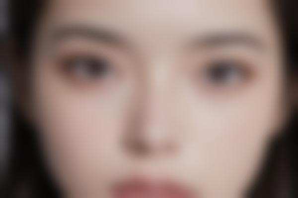 广州高尚医疗美容中心眼眸修复手术指南