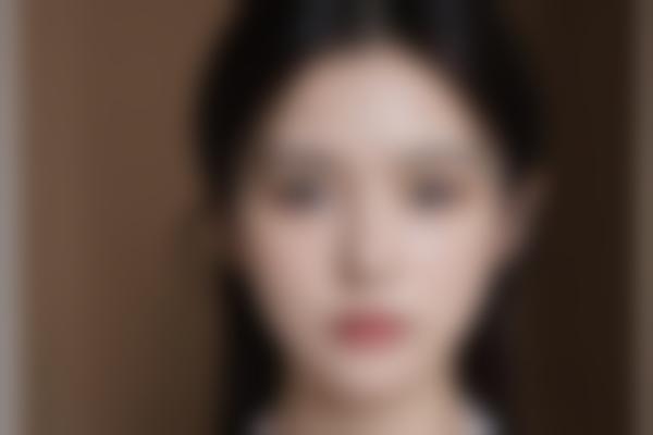 2024成都优蔓尔医疗美容门诊部价格表：、吸脂、面部整形项目收费标准