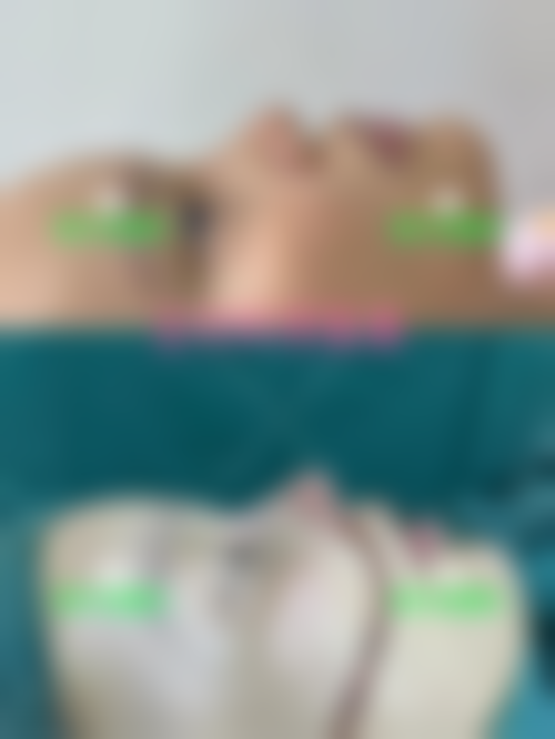 上海美漾医疗美容诊所真实实例