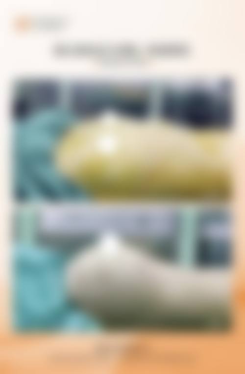 韩国Ieul整形外科仪器设备：精良科技助力美丽升级