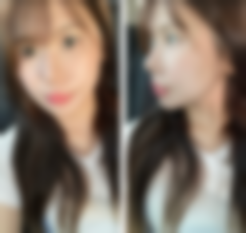 鸡西御美整形医院口碑怎么样：众多顾客的美丽之选