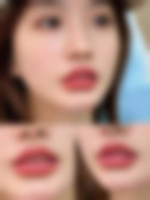 扬州俏华美医疗美容诊所价格表