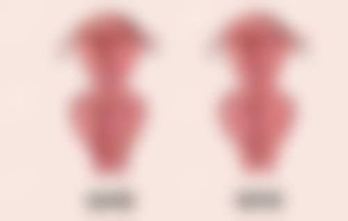 武科 大附属紫荆医院医疗美容科祛疤色素成效好吗？