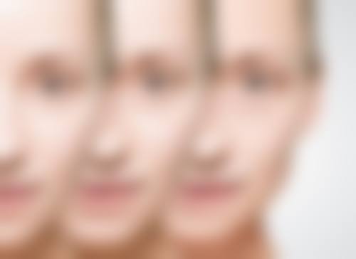 西安莲湖西交去除疤痕疙瘩怎么样？