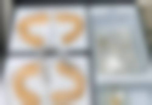 激光祛疤对于参军手术疤痕修复值不值?