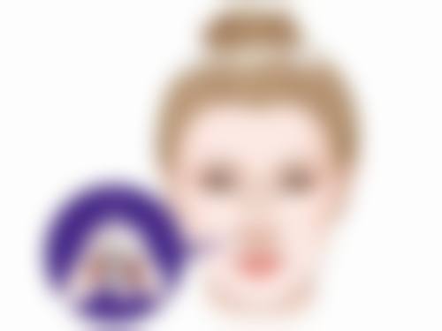 Sculptra塑然雅能改善参军手术疤痕吗?