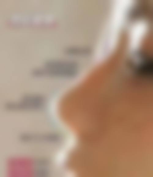 呼伦贝尔海拉尔董海杰整形医院价格表