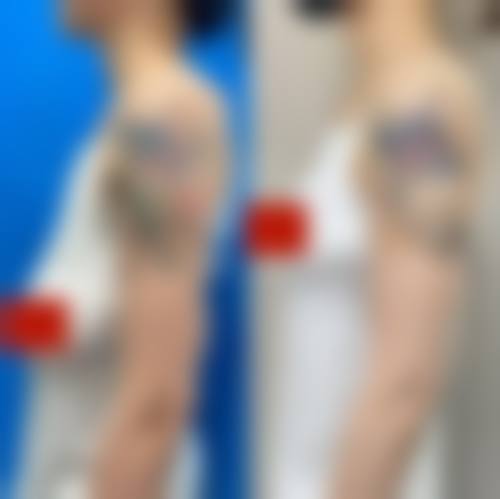 厦门欧韵整形医院价格表