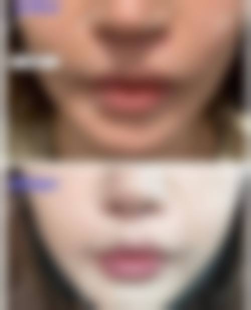 青海大学附属医院医学美容科预约挂号方式：简单便捷享美丽