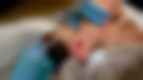 咸阳长城医院医疗美容科真实实例：眼见为实的美丽蜕变