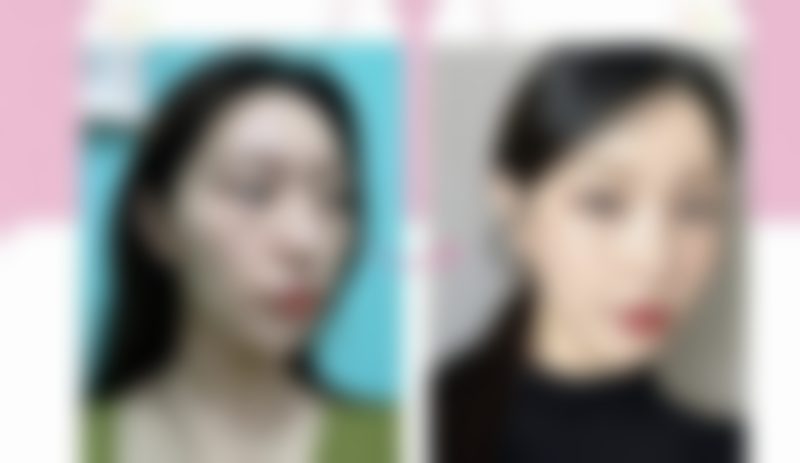 姚泽忠医生（上海莱佛士医院）擅长领域