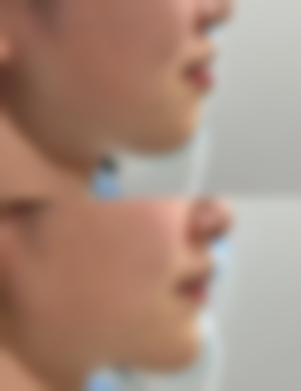 博白悦莱美整形医院营业时间：合理安排变得更美时间