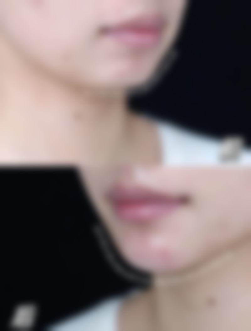 阆中阿蓝整形医院擅长项目：满足多样美丽需求