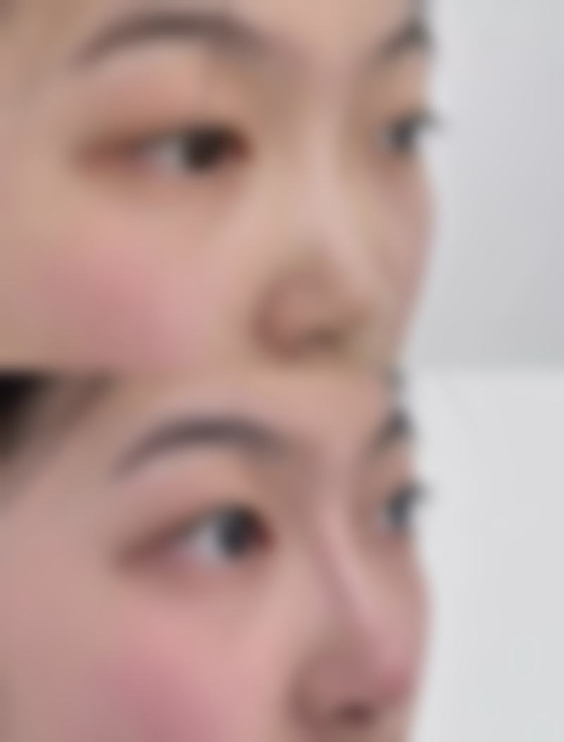 厦门欧韵整形医院擅长项目