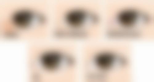 不同麻醉方式取出假体隆胸术后修复差异大吗？