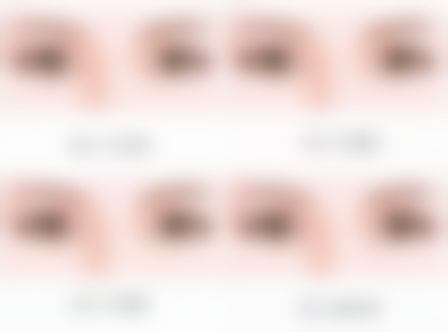 北京圣嘉新医疗美容医院做韩式双眼皮适合吗？