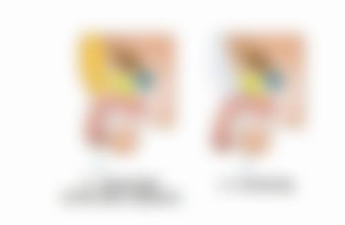 瘦脸针和下巴一起打有哪些注意事项