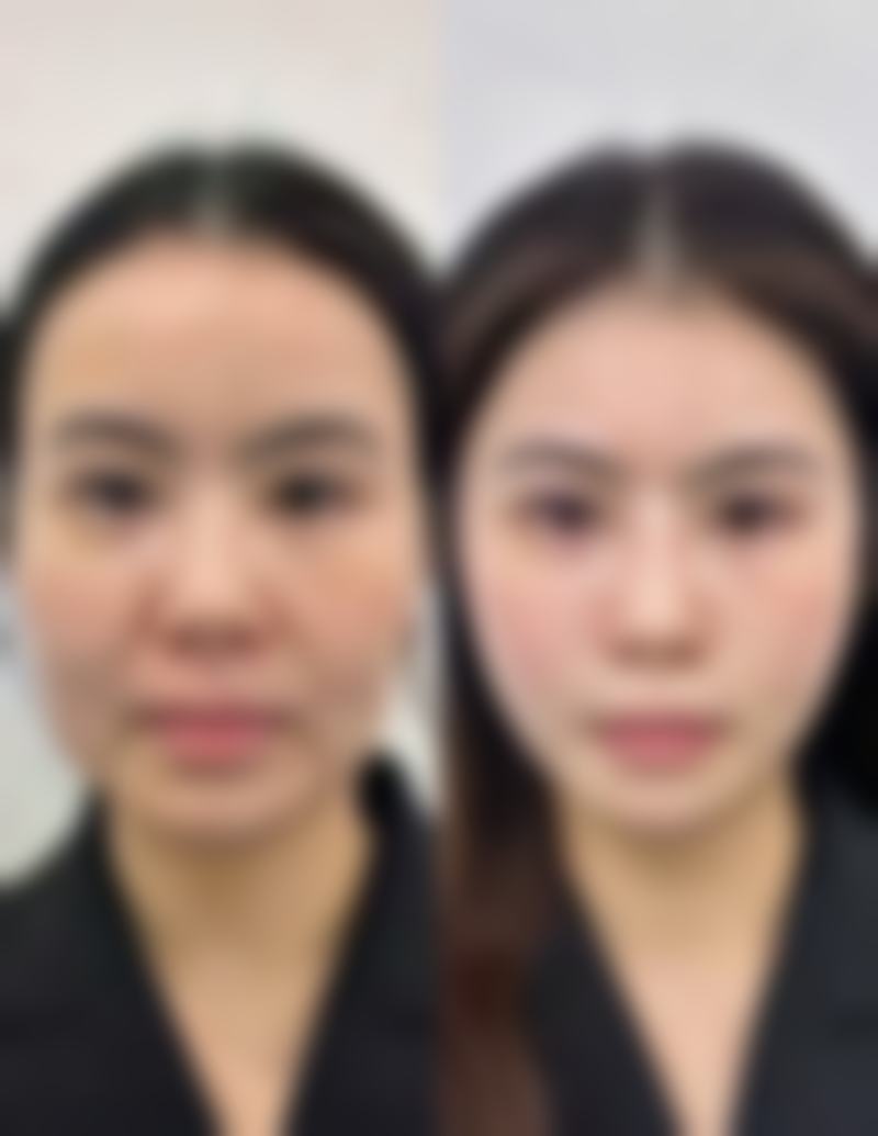 姚大夫的真实实例