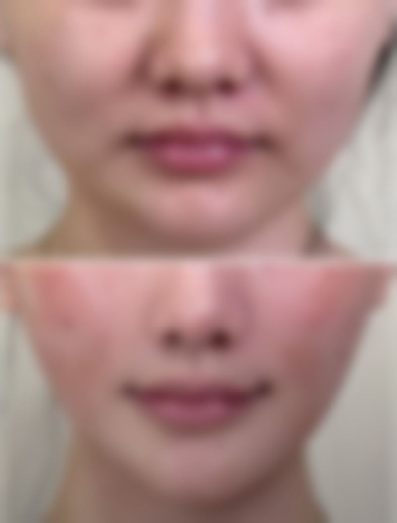 赵大夫的技术特点