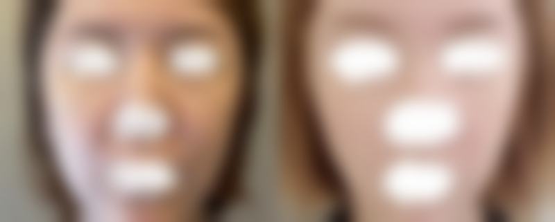 上饶信州荣美医疗美容门诊部预约挂号方式：便捷效率高不等待