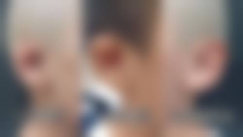 芦荟可以淡化疤痕吗？靠谱吗？