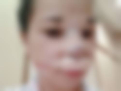 西安莲湖西交疤痕鉴定疤痕体质专精吗？