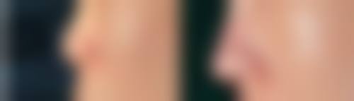 成都军建医院鉴定疤痕体质值得去吗？