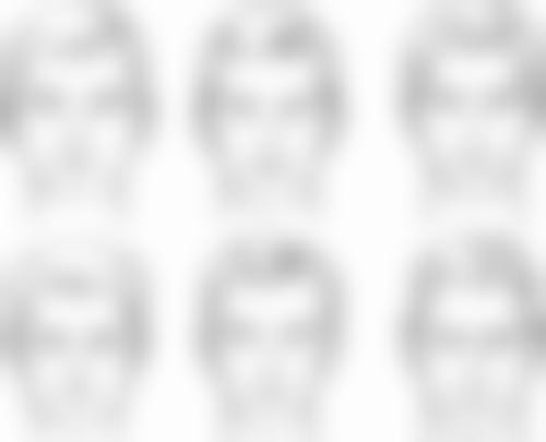 杭州舒睿莱医疗美容诊所真实实例