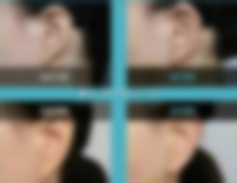 姚志峰医生技术特点