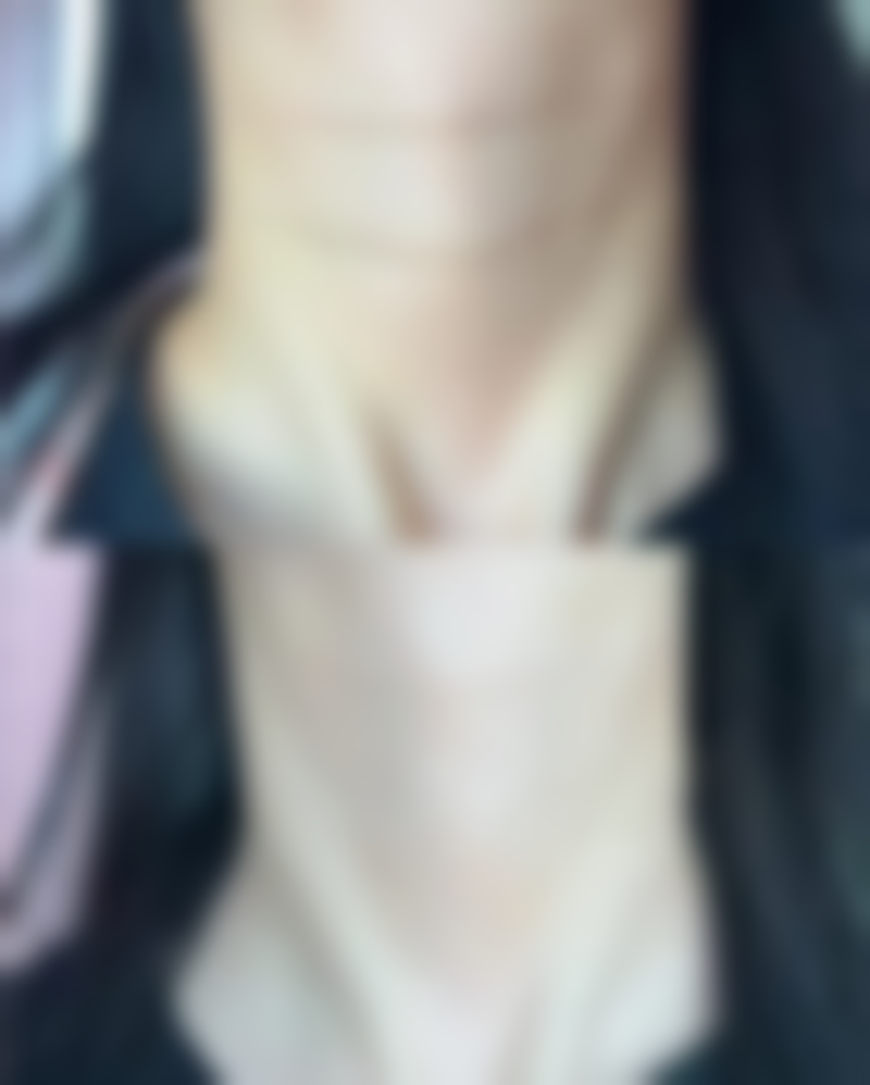 西安莲湖西交疤痕祛增生性疤痕值不值