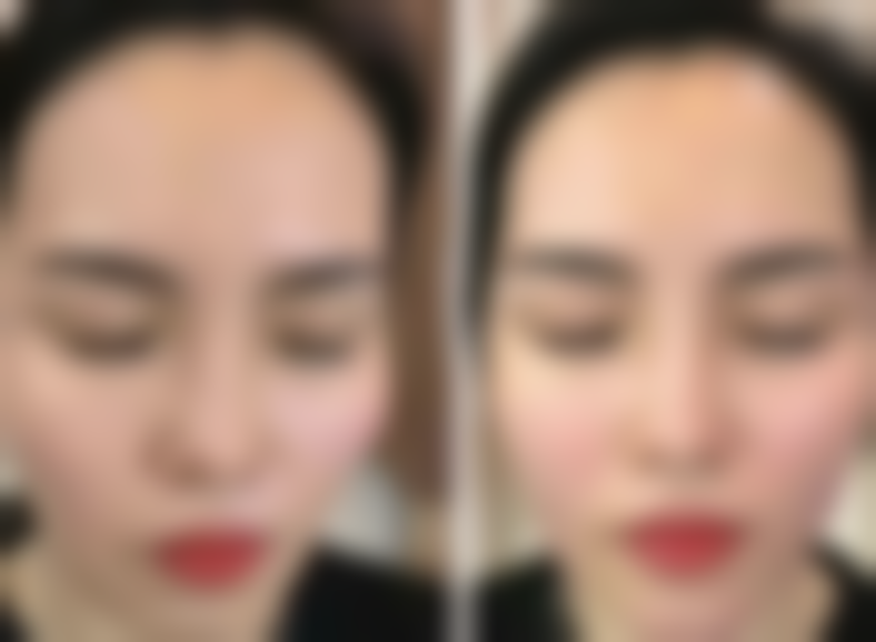 南京康丽整形美容医院口碑怎么样：顾客真实评价