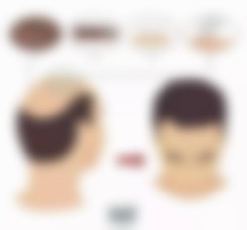 刘新娟医生的真实实例