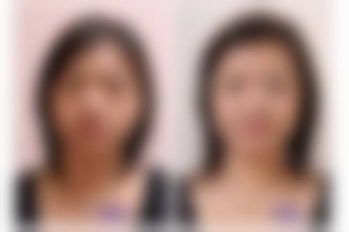 姚志峰医生真实实例