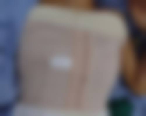 泉州海峡医疗美容门诊部做阴道紧缩术风险大吗？