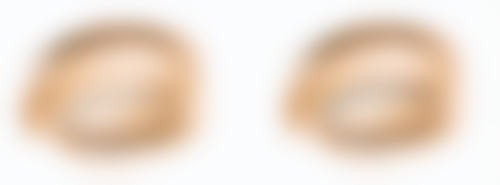 肚子吸脂减肥受哪些关键因素影响