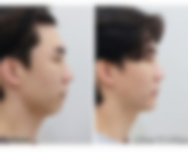 包建军 医生口碑评价：求美者的一致好评