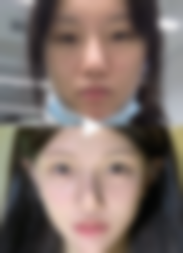 铜陵艺美人医疗美容门诊部真实实例