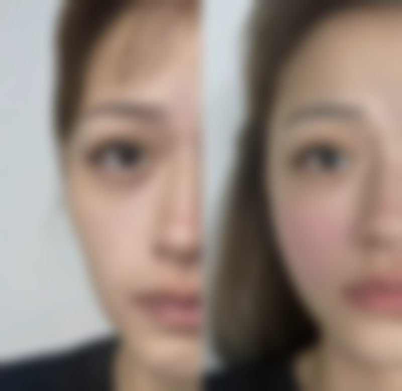 深圳煌越植发医疗美容门诊部电话号码