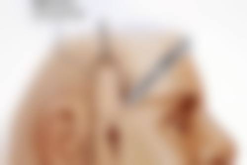 呼和浩特京美医疗美容医院41岁割双眼皮值不值？