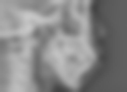 北京嘉禾医疗美容祛眼袋适合我吗？