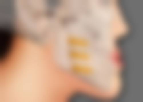 北京禾美嘉医疗美容处理隆胸假体破裂值不值？