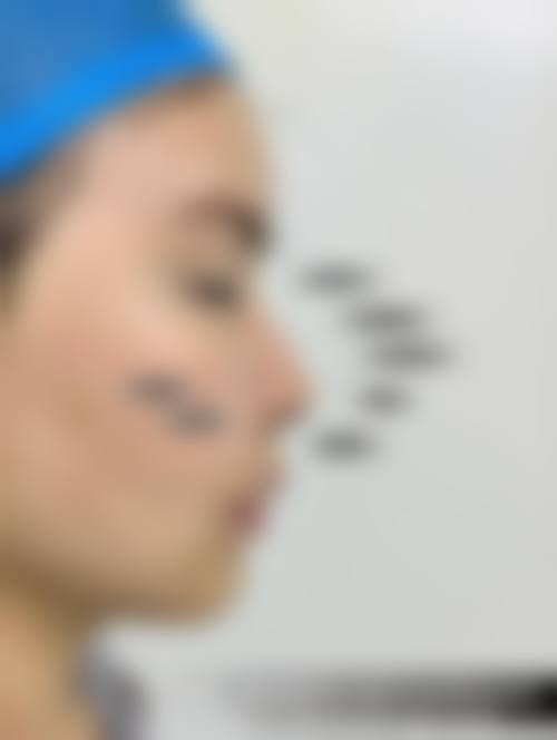 成都美瑞皮肤美容门诊部真实实例