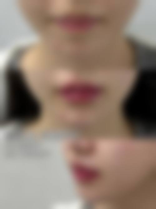 广州求美医学美容医院电话号码:随时沟通