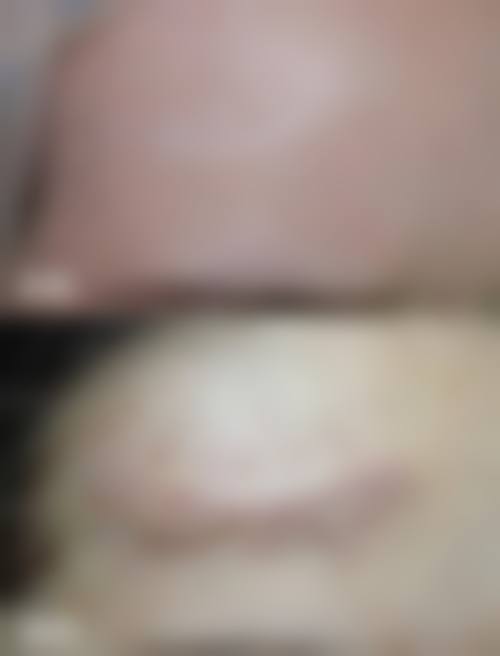 深圳积美整形医院营业时间：贴心服务不打烊